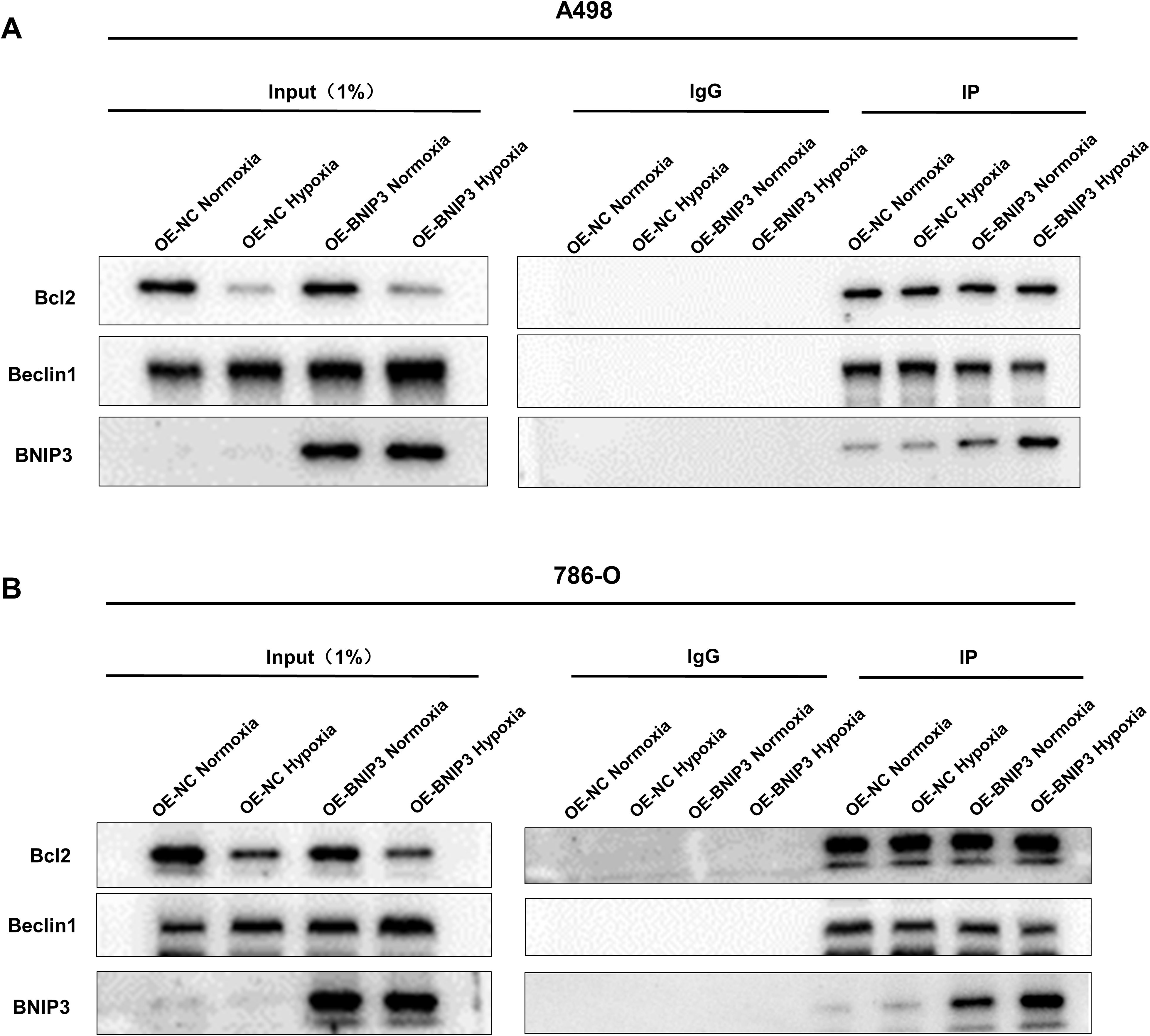 Western blot panels showing protein bands for Bcl2, Beclin1, and BNIP3 under different conditions. Panel A compares A498 cells with conditions labeled as OE-NC Normoxia, OE-NC Hypoxia, OE-BNIP3 Normoxia, and OE-BNIP3 Hypoxia. Panel B shows similar conditions for 786-O cells. Input, IgG, and IP sections are marked in both panels with varying band intensities for each protein.