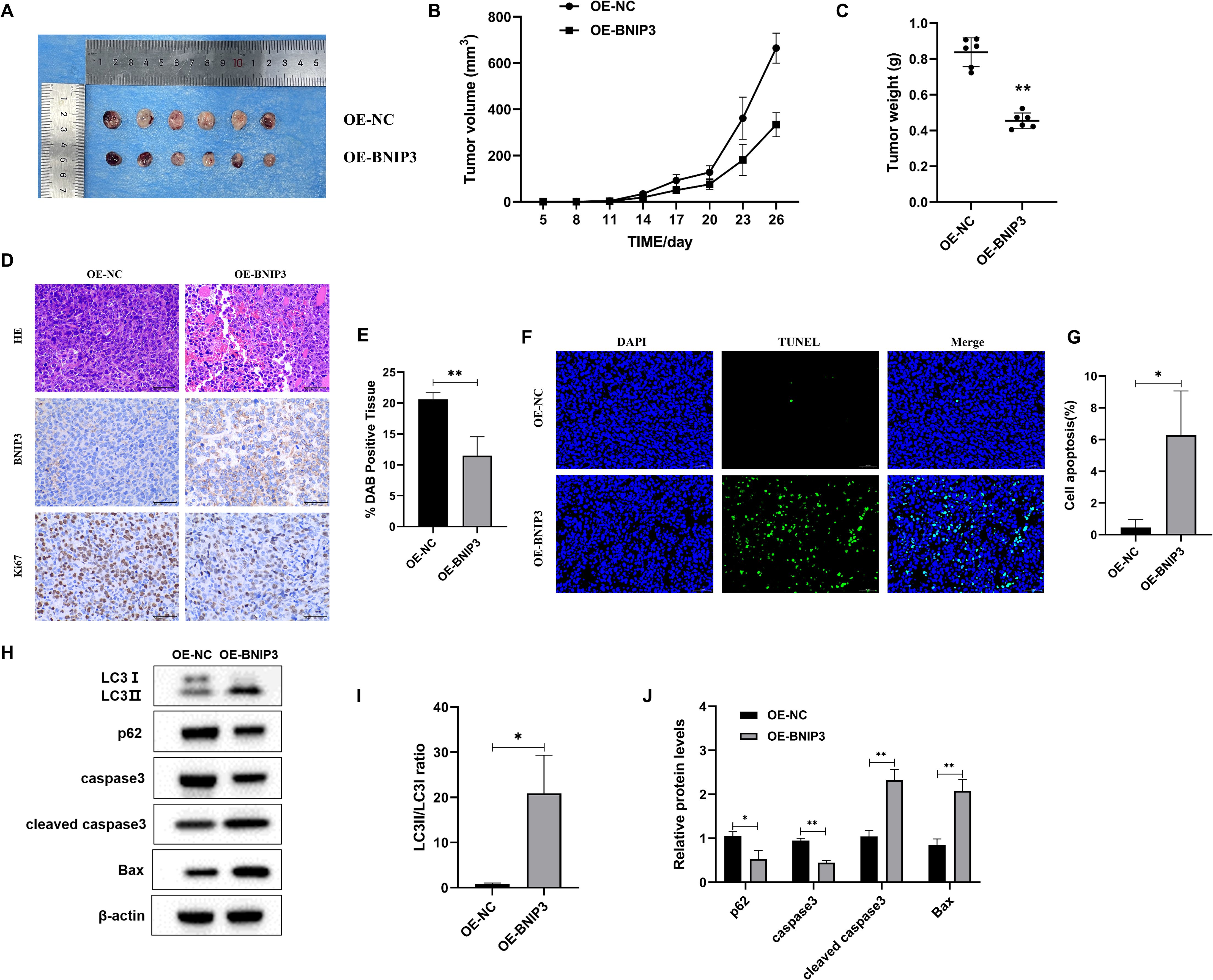Composite image showing results from a scientific study on tumor growth and apoptosis in two groups: OE-NC and OE-BNIP3. (A) Displays tumor samples with a ruler for scale. (B) Line graph comparing tumor volume over time. (C) Scatter plot of tumor weight, showing significant differences. (D) Microscopic tissue images with various stains. (E) Bar graph of DAB positive tissue percentage. (F) Fluorescent images showing cell apoptosis. (G) Bar graph comparing cell apoptosis rates. (H) Western blot of protein expressions: LC3, p62, caspase 3, Bax, and β-actin. (I) Bar graph of LC3I/LC3II ratio. (J) Bar graph of relative protein levels. Significant differences are indicated with asterisks.