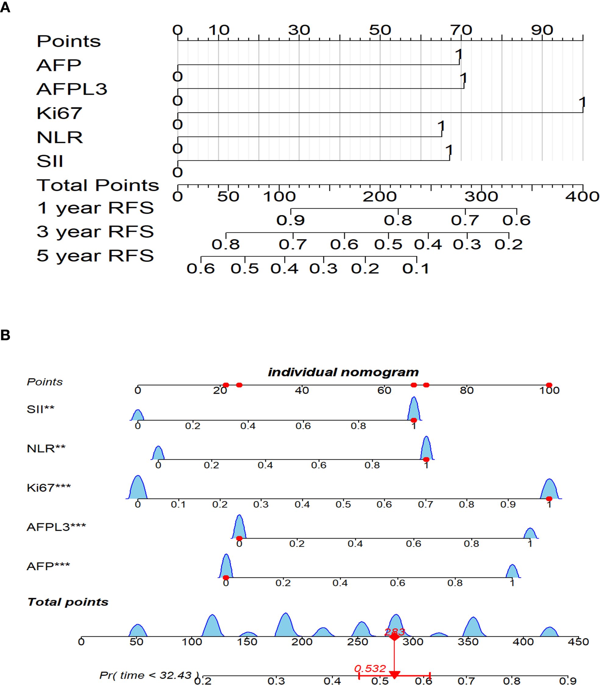Diagram A shows a point system correlating various factors like AFP, AFPL3, Ki67, NLR, and SII with total points and recurrence-free survival (RFS) at one, three, and five years. Diagram B presents an individual nomogram with plotted points for SII, NLR, Ki67, AFPL3, and AFP, indicating their contributions to total points and survival probabilities.
