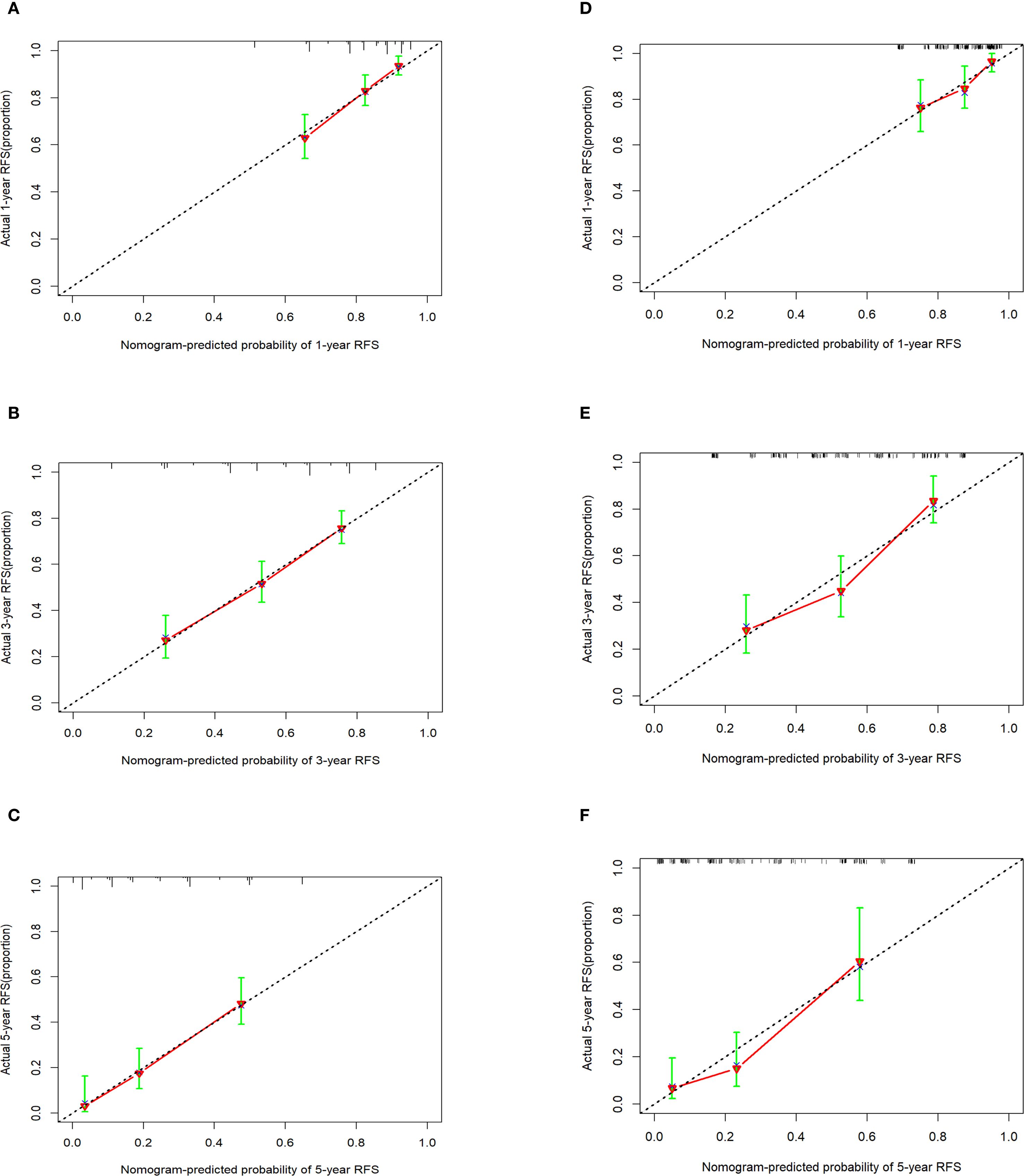 Image consists of six calibration plots showing the relationship between nomogram-predicted probabilities and actual recurrence-free survival (RFS) proportions at one, three, and five years. Plots A, B, and C represent different nomogram predictions over time, with a diagonal line indicating perfect prediction. Plots D, E, and F similarly depict different sets of predictions. Data points are marked in red with green error bars, demonstrating performance consistency and discrepancies.