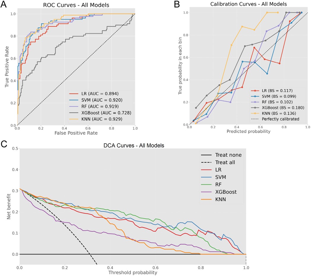 Composite image featuring three plots comparing different models. Panel A shows ROC curves for Logistic Regression, SVM, Random Forest, XGBoost, and KNN, with AUC values indicated. Panel B displays calibration curves for the same models, highlighting Brier Scores. Panel C presents DCA curves, analyzing net benefit across varying threshold probabilities, comparing treat-all versus treat-none strategies. Each model's performance is color-coded consistently across the panels.