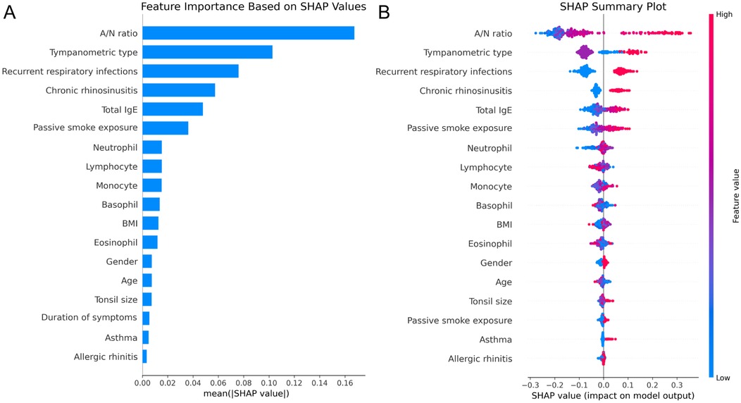 Panel A shows a bar chart of feature importance based on SHAP values, highlighting A/N ratio, tympanometric type, and recurrent respiratory infections as the most significant features. Panel B is a SHAP summary plot illustrating the impact of each feature value on model output, with A/N ratio being the most influential. Color gradient from blue to pink represents low to high feature values.