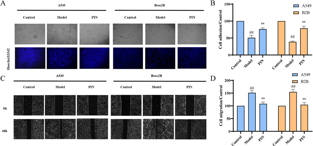 Panel A shows images of A549 and Beas2B cells under different conditions: Control, Model, and PIN, both unstained and Hoechst33342 stained. Panel B is a bar graph comparing cell adhesion in A549 and B2B cells across these conditions, highlighting significant differences. Panel C presents A549 and Beas2B cell migration at 0 and 48 hours under similar conditions. Panel D displays a bar graph comparing cell migration among these conditions, also indicating significant variations.