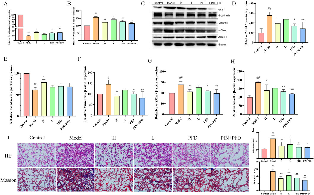 Bar graphs and Western blot analyses display protein expressions of Ecadherin, vimentin, ZEB1, α-SMA, and Snail1 across control, model, and treatment groups. Panels I show HE and Masson staining of lung tissues across the same groups, highlighting structural differences. Each treatment group exhibits varying effects on protein expression and tissue morphology compared to control and model. Panels J show Pulmonary index and Ashcroft scoring in mice.