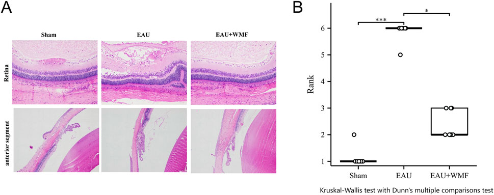 Histological images show retinal and anterior segment layers under sham, EAU, and EAU plus WMF conditions. Bar graph displays rank comparisons across these groups, analyzed using Kruskal-Wallis test with Dunn's multiple comparisons, indicating statistical significance.