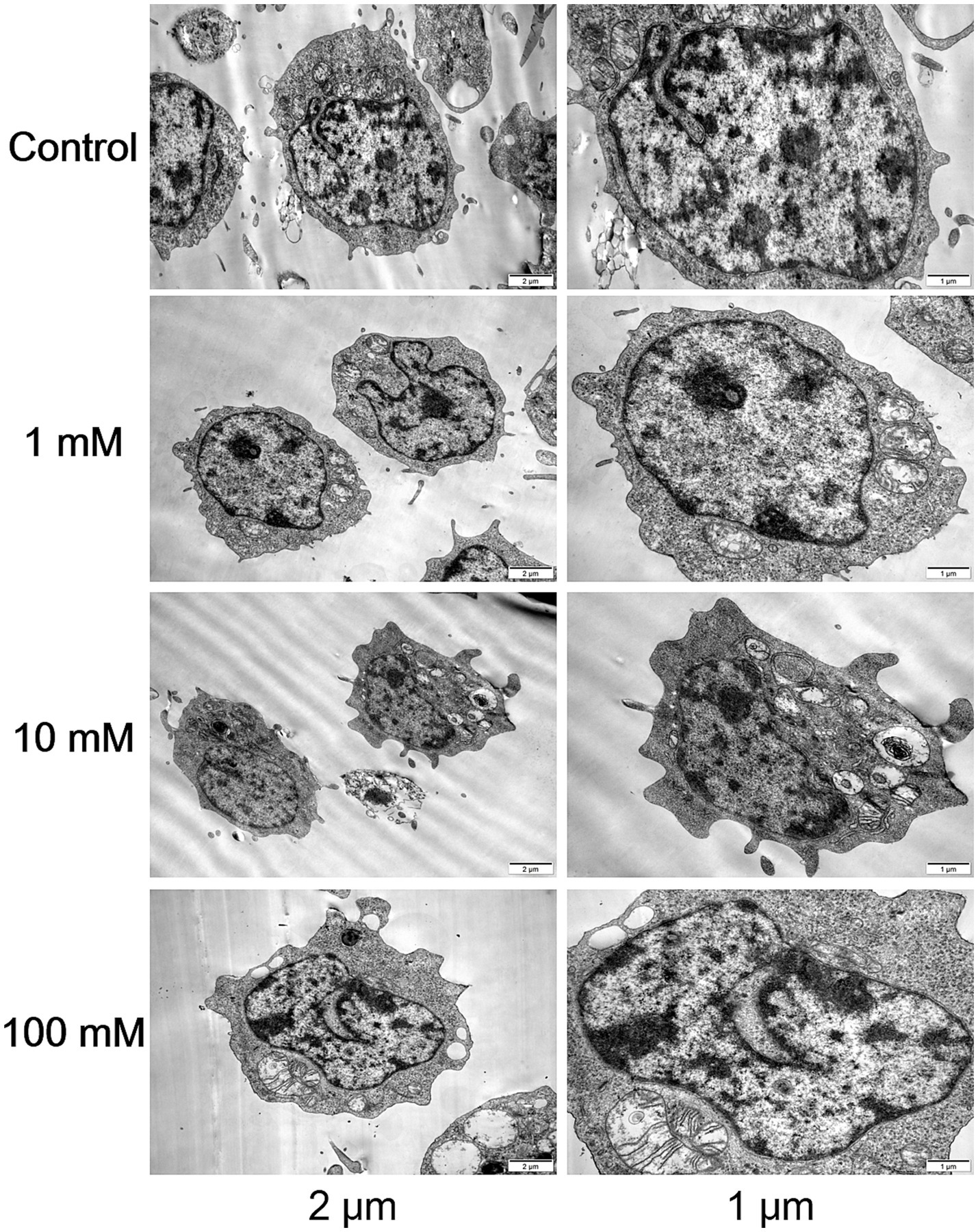 Electron micrographs displaying cellular structures at different concentrations: Control, 1 mM, 10 mM, and 100 mM. Cells show varied morphological changes with increasing concentrations, magnified at two micrometers and one micrometer scale.