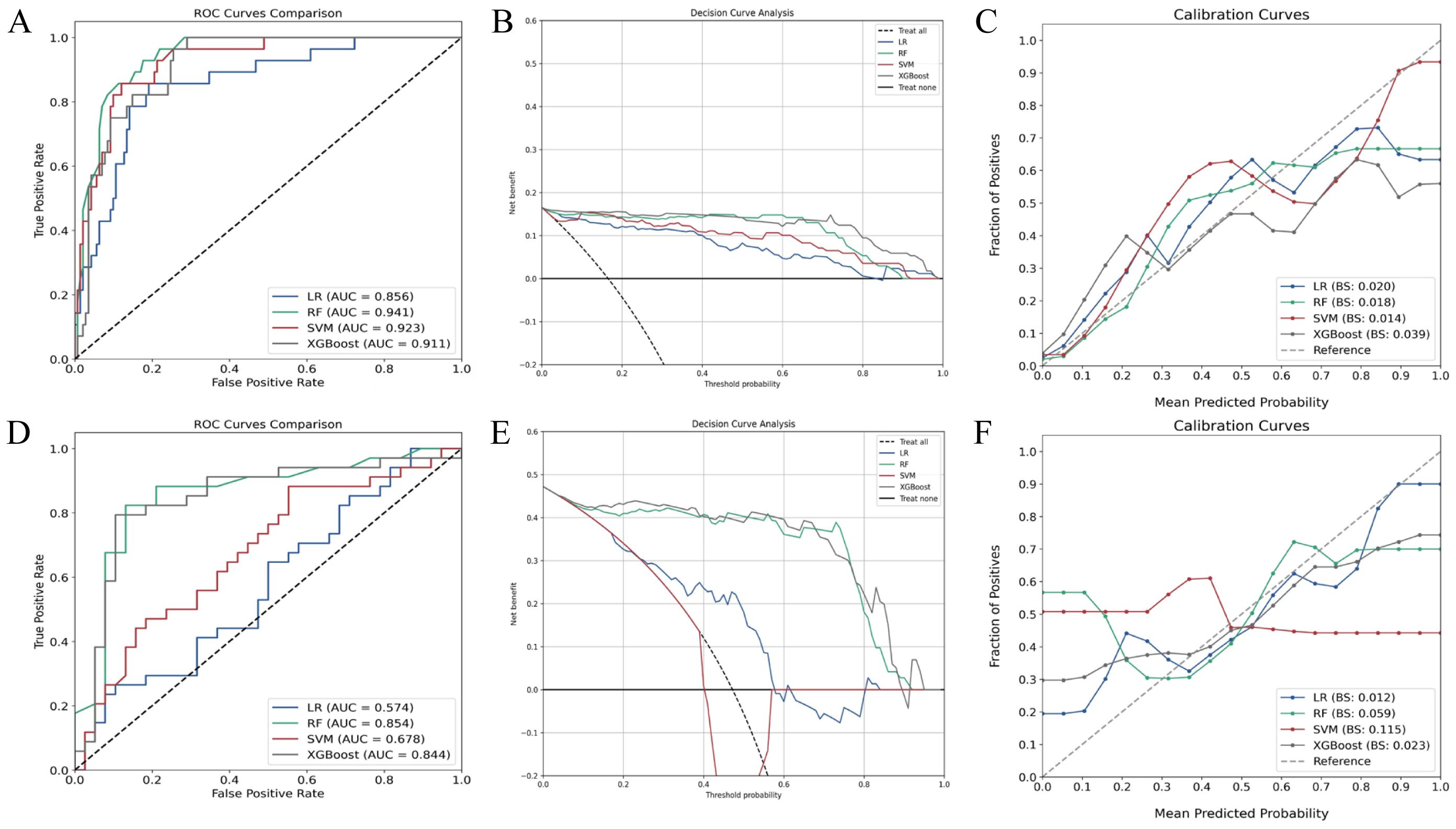 Panel A shows ROC curves for LR, RF, SVM, and XGBoost models, with RF achieving the highest AUC of 0.941. Panel B displays decision curve analysis with various treatment options. Panel C illustrates calibration curves, with SVM showing the lowest Brier score. Panel D presents ROC curves for different models, with RF reaching an AUC of 0.854. Panel E shows decision analysis with net benefits for different thresholds. Panel F depicts calibration curves, where XGBoost achieves the lowest Brier score. Each panel compares different model performance metrics.