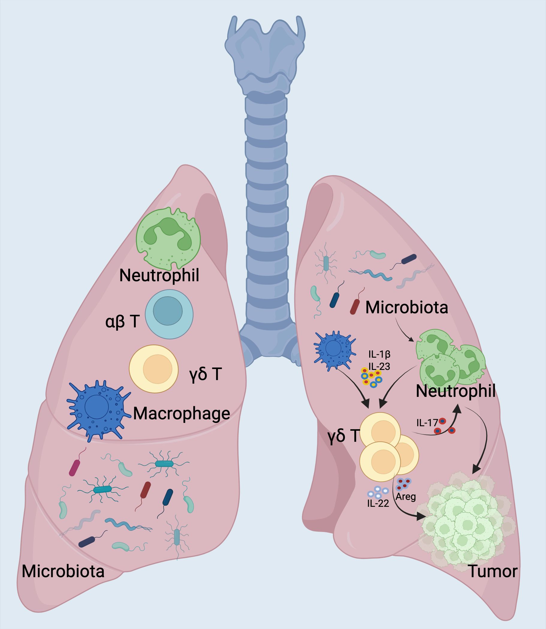 Illustration of lungs showing interactions between immune cells, microbiota, and a tumor. Left lung labeled with neutrophil, αβ T, γδ T, macrophage, and microbiota. Right lung features microbiota, tumor, and interactions via IL-1β, IL-23, IL-17, IL-22, and Areg involving neutrophils and γδ T cells.