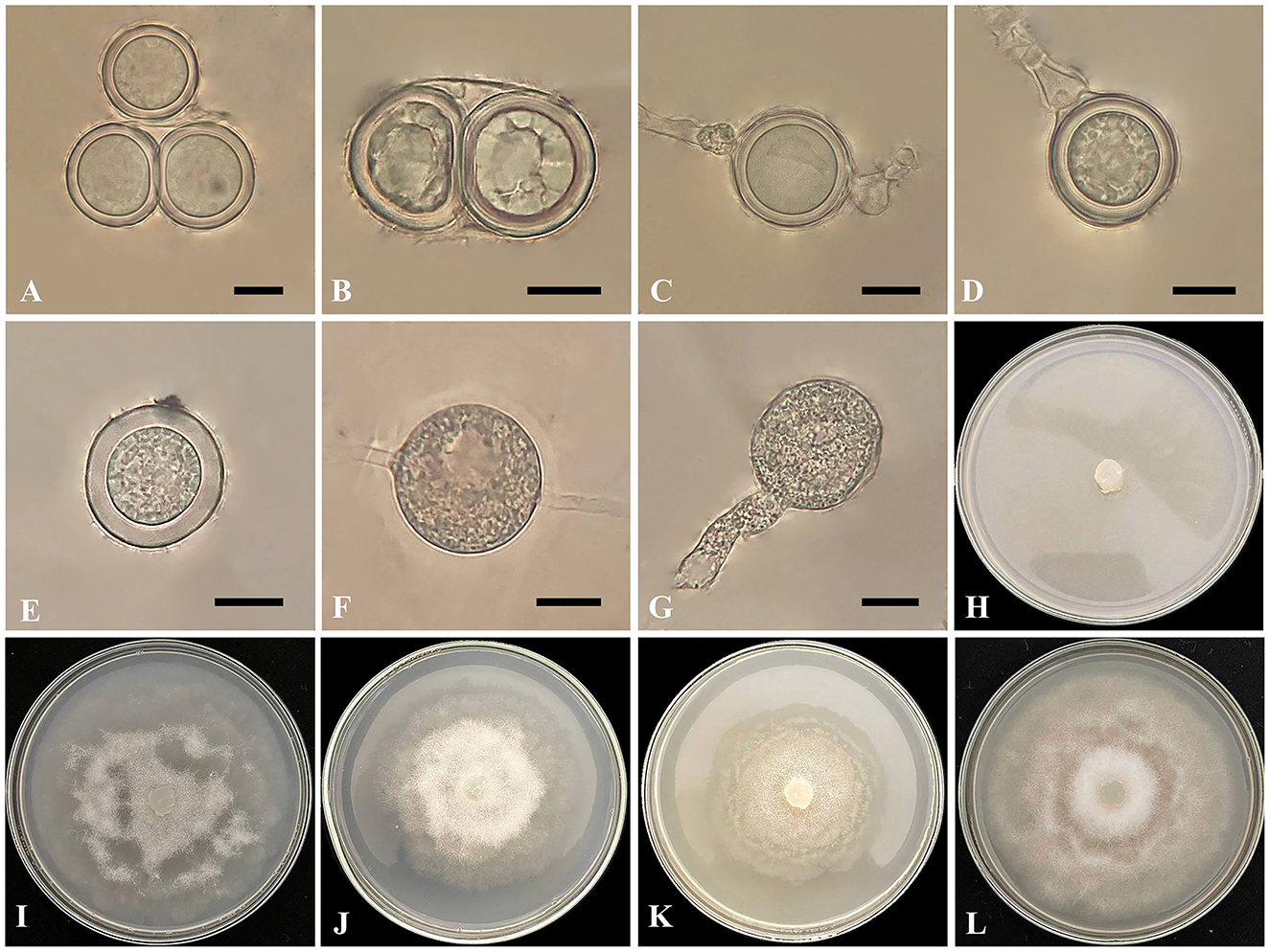 Microscopic images (A-G) display various reproductive structures and spores of Globisporangium parvizense isolate IRAN 5217C, including oospores, intercalary and terminal oogonia with antheridia, and sporangia with discharge tubes. Images (H-L) show fungal colony growth on different culture media in petri dishes: Corn Meal Agar (CMA), Potato Carrot Agar (PCA), Potato Dextrose Agar (PDA), Malt Extract Agar (MEA), and V8 Juice Agar (V8A). Scale bars indicate 10 μm.