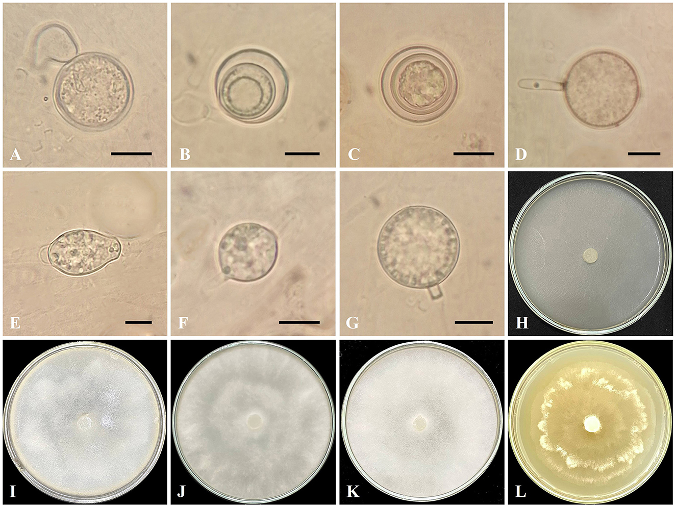 Microscopic images (A–G) display various reproductive structures and spores of Globisporangium sarabense isolate IRAN 5173C, including oogonium with one antheridium, aplerotic oospores, and sporangia (intercalary and terminal) with discharge tubes. Images (H-L) show fungal colony growth on different culture media in petri dishes: Corn Meal Agar (CMA), Potato Carrot Agar (PCA), Potato Dextrose Agar (PDA), V8 Juice Agar (V8A), and Malt Extract Agar (MEA). Scale bars indicate 10 μm.
