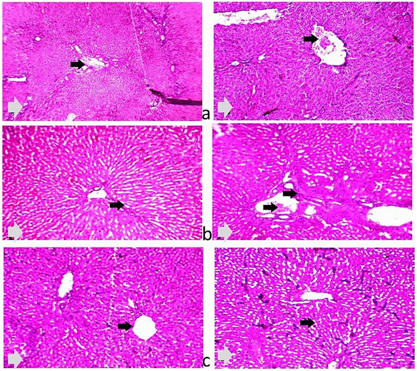 Histological images of liver tissue sections with different treatment groups labeled a, b, and c. Each section is stained, showing cellular structures in pink. Black arrows indicate specific areas of interest, such as cell nuclei or tissue changes. Differences in tissue patterns and structures are noted across the various sections.