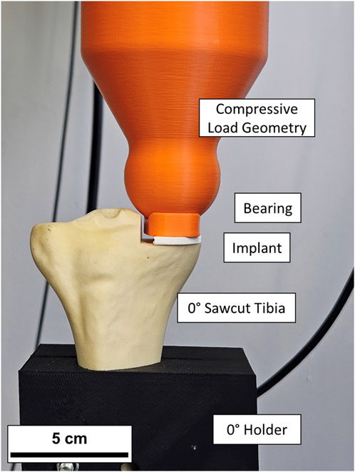 An orange compressive load geometry applies force on a bone model, labeled as