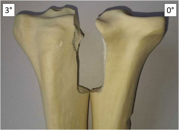 Two bone fragments with a clear break in between, showing rough edges. The angle of separation is marked as three degrees on the left and zero degrees on the right.