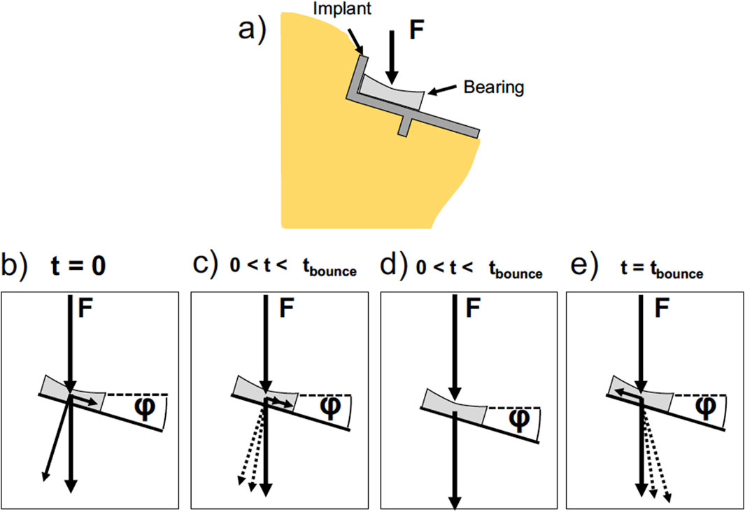Illustration of an implant's motion under force. Panel a shows a cross-section of an implant and bearing with force F applied. Panels b to e depict motion stages: b) t = 0, c) 0 < t < tbounce, d) 0 < t < tbounce, and e) t = tbounce, with the implant depicted at angles. Arrows indicate force direction and motion, with the angle phi marked in each stage.