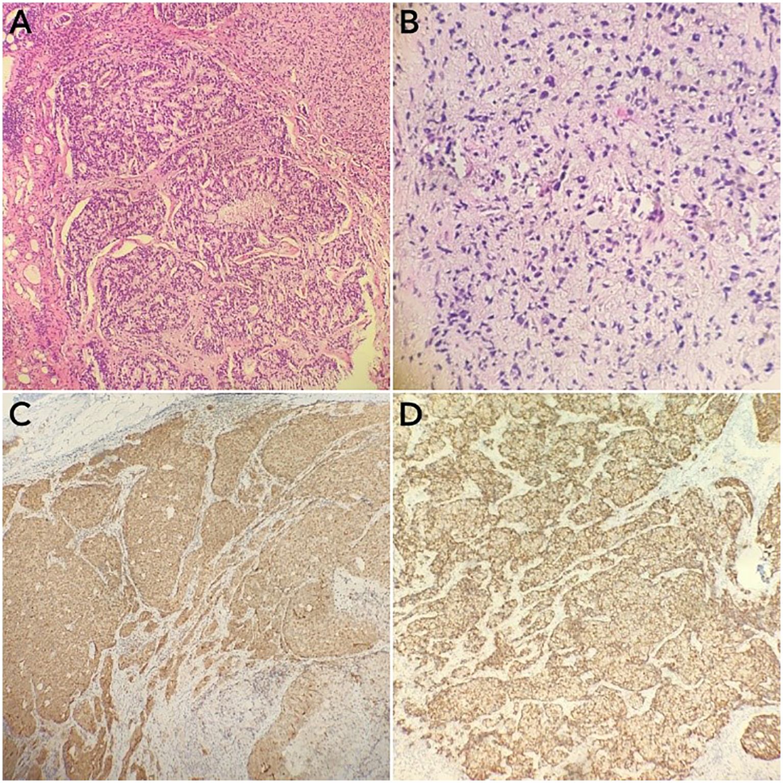 Histological analysis of tissue samples consists of four images labeled A, B, C, and D. A shows dense cellular structures with a pink and purple stain. B displays a less organized arrangement with darker purple nuclei. C and D have broader areas with brownish and whitish tones, highlighting different tissue patterns and densities.