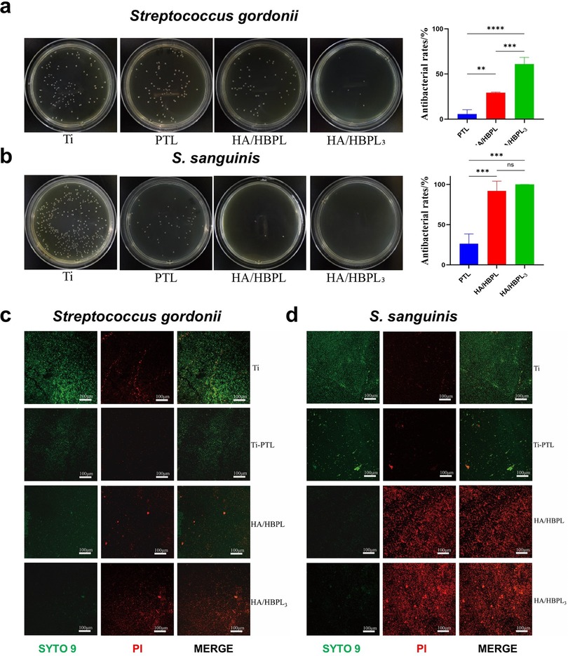 Petri dishes and fluorescence microscopy images examining the antibacterial effects of different coatings on Streptococcus gordonii and S. sanguinis. (a) and (b) show bacterial colonies on different coatings with corresponding bar graphs indicating antibacterial rates. (c) and (d) display fluorescence images using SYTO 9 and propidium iodide on the bacteria under similar conditions, highlighting live and dead cells with a merge image. Each row and column represents variations in coatings, emphasizing differences in antibacterial effectiveness.