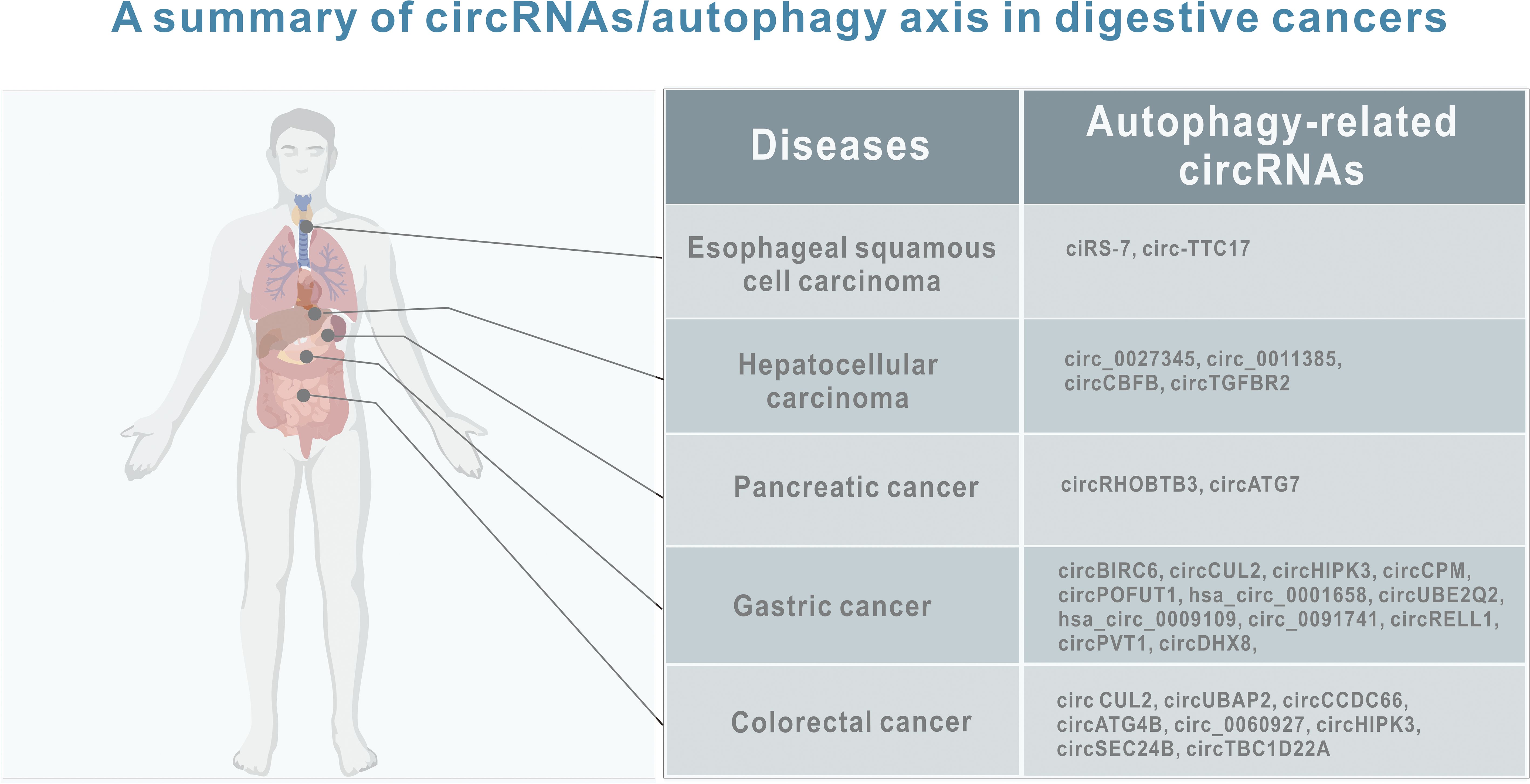 Summary image showing circRNAs related to autophagy in digestive cancers. Left: illustration of a human torso highlighting the esophagus, liver, pancreas, stomach, and colon. Right: table listing diseases with corresponding autophagy-related circRNAs. Diseases include esophageal squamous cell carcinoma, hepatocellular carcinoma, pancreatic cancer, gastric cancer, and colorectal cancer, each linked to specific circRNAs such as ciRS-7 and circ-TTC17.