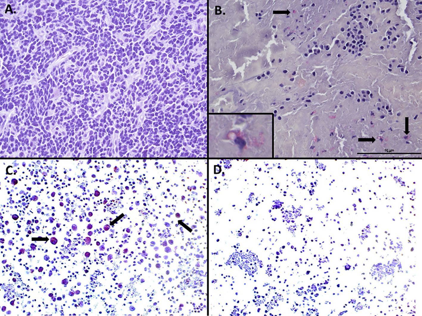 Microscopic images in a grid labeled A to D. Panel A shows dense purple-stained cells. Panel B highlights scattered dark cells in a lighter matrix with black arrows pointing to specific areas. Panel C displays a spread of purple-stained cells with arrows indicating significant cells. Panel D presents dispersed purple-stained cells in a mostly clear field. Each image likely represents different staining or sections in a histological analysis.