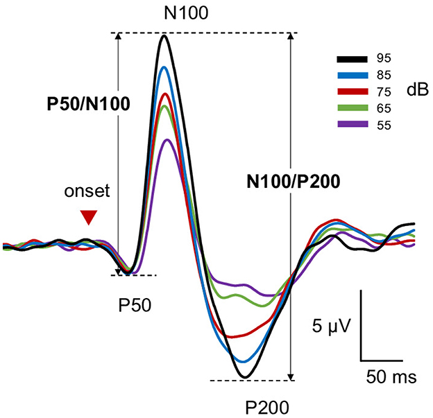 Waveform graph depicting auditory evoked potentials labeled P50, N100, and P200. Lines in black, blue, red, green, and purple represent different decibel levels: 95, 85, 75, 65, and 55 dB respectively. The x-axis shows time in milliseconds, and the y-axis displays amplitude in microvolts. A red arrow indicates the onset.