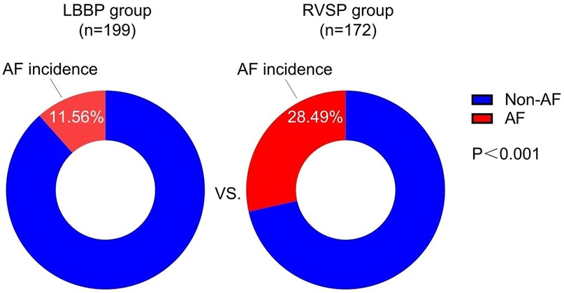 Two pie charts compare atrial fibrillation (AF) incidence in LBBP and RVSP groups. The LBBP group shows 11.56% AF incidence, while the RVSP group shows 28.49%. Blue represents non-AF, and red represents AF. The p-value is less than 0.001.