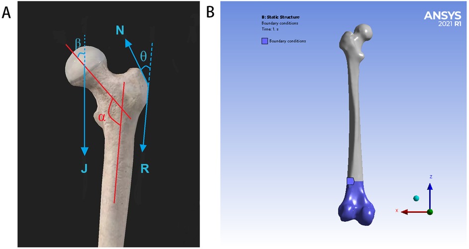 Panel A shows a human femur with angles labeled in blue and red, depicting anatomical orientations. Panel B is a 3D model of the femur with a focus on boundary conditions, indicated in blue, using ANSYS software. The coordinate system is illustrated with X, Y, and Z axes.