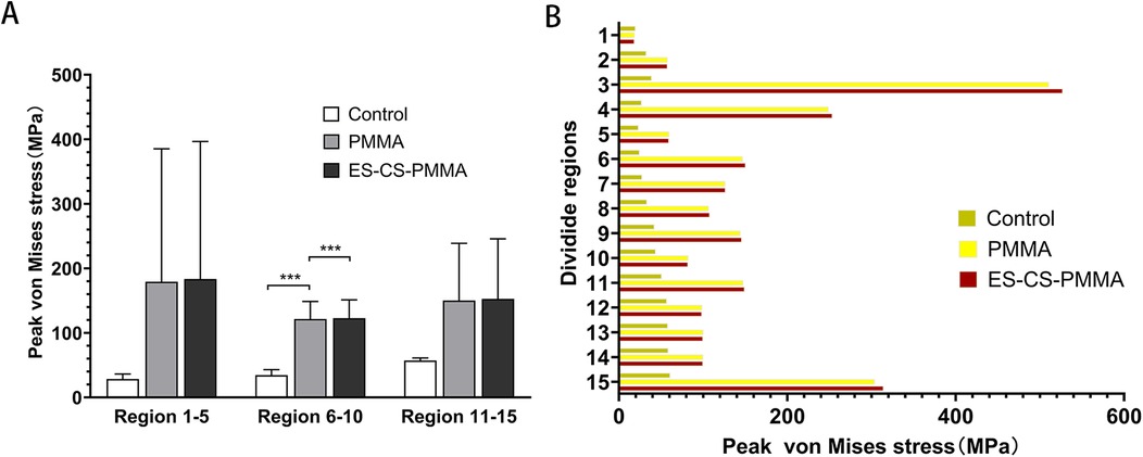 Chart A is a bar graph showing peak von Mises stress (MPa) in regions 1-5, 6-10, and 11-15, comparing Control, PMMA, and ES-CS-PMMA groups. Chart B is a horizontal bar graph displaying von Mises stress across fifteen divided regions for the same groups, identifying Control in green, PMMA in yellow, and ES-CS-PMMA in red. Significant differences are indicated with asterisks.