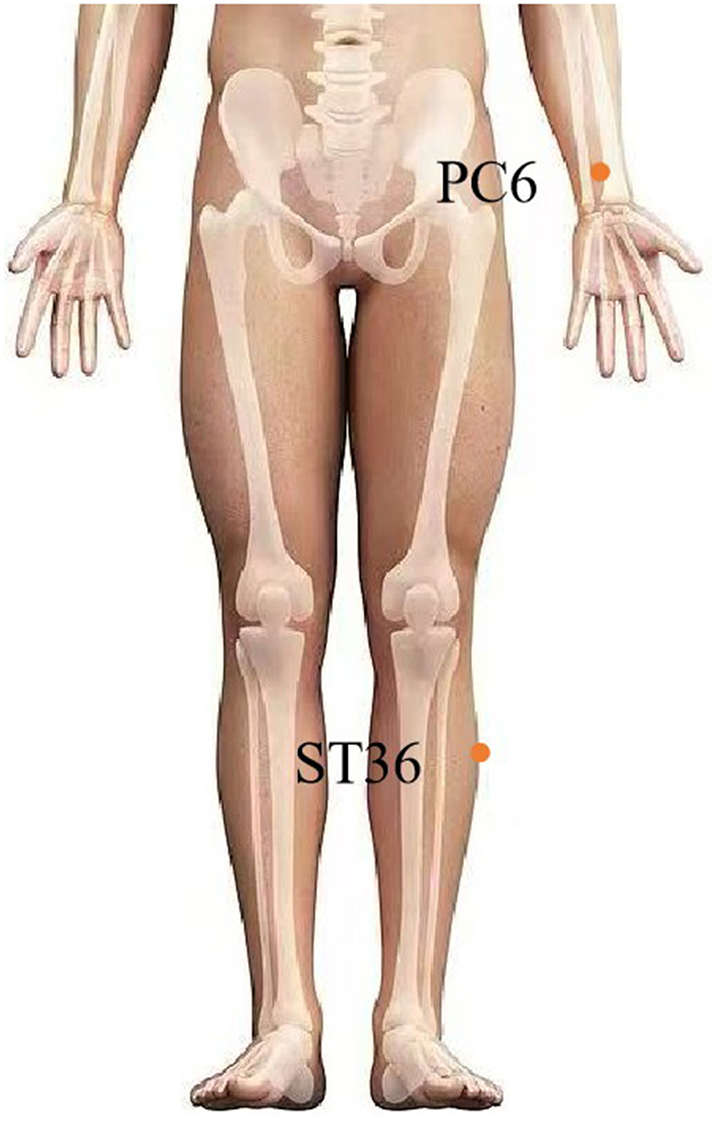 Diagram of a human body from the front view, highlighting acupuncture points PC6 on the inner forearm and ST36 below the knee. Bone structures are visible as overlays. Caption: “EA at Classic Acupoints for NVP/HG Management.”