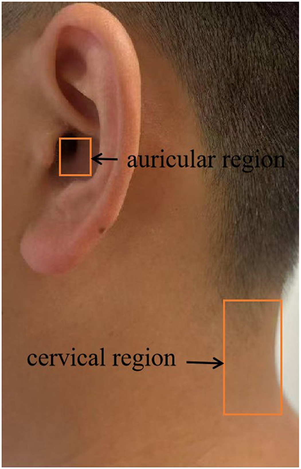 Close-up of a person‘s ear and neck, highlighting two areas. The “auricular region” near the ear and the “cervical region” on the neck are marked with orange rectangles and labeled with arrows.