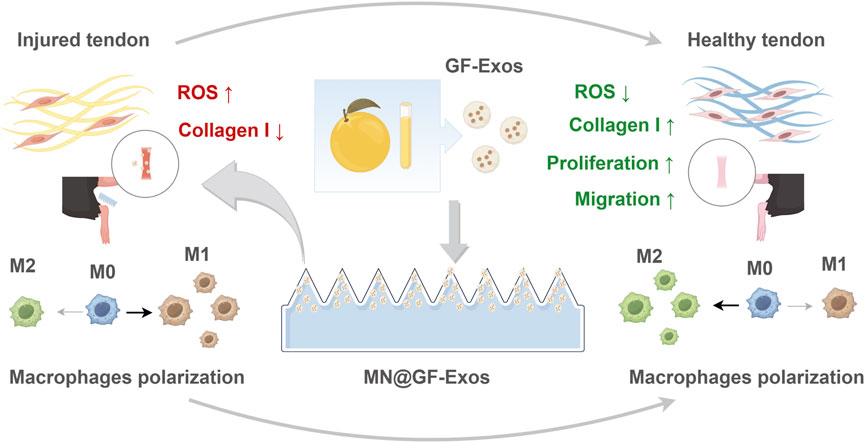 Diagram illustrating the process of tendon healing using GF-Exos. Injured tendons show increased ROS and decreased collagen I. The application of GF-Exos leads to reduced ROS, increased collagen I, and enhanced proliferation and migration, promoting tendon health. It demonstrates macrophage polarization from M0 to M1, then to M2, both in injured and healthy tendons. The GF-Exos are depicted being applied to micro-needles (MN@GF-Exos) to aid the healing process.