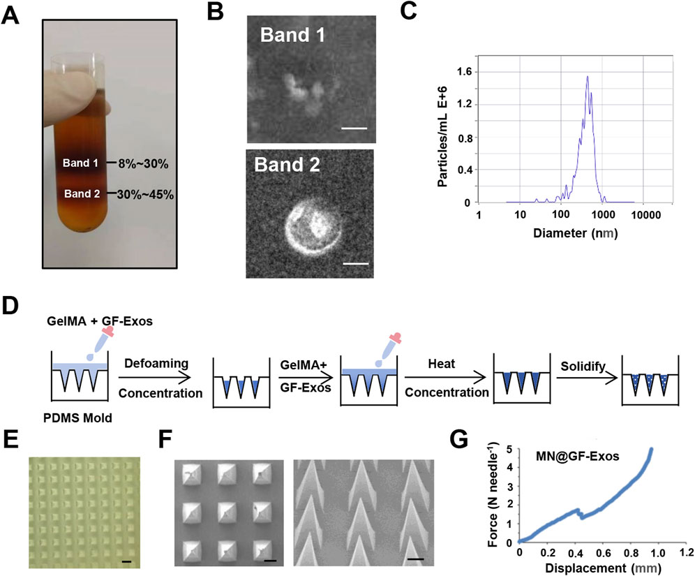 A composite scientific image shows: A) A test tube with two distinct bands labeled with concentration ranges, B) Microscopic images of Bands 1 and 2, C) A graph of particle diameter distribution showing a peak, D) A schematic illustrating the preparation process of GelMA with GF-Exos using defoaming, concentration, heating, and solidifying in a PDMS mold, E) A grid of microneedles, F) Microscopic images of microneedle tips, G) A graph plotting force against displacement for MN@GF-Exos. Each panel illustrates a step or component of a scientific process.