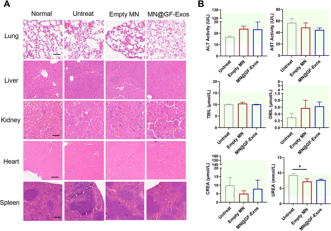 Panel A shows histological images of lung, liver, kidney, heart, and spleen tissues under different treatment conditions: Normal, Untreated, Empty MN, and MN@GF-Exos. Panel B presents bar graphs comparing ALT, AST activities, TBIL, DBIL, CREA, and UREA levels among Untreated, Empty MN, and MN@GF-Exos groups. There is a significant change in UREA marked with an asterisk.