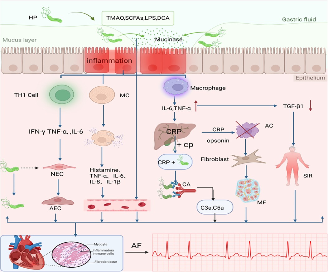 Diagram depicting the inflammatory process triggered by Helicobacter pylori (HP) in the gastric epithelium, leading to systemic inflammation. Pathways show interactions of TH1 cells, macrophages, and fibroblasts with cytokines like IL-6, TNF-alpha, and interferon-gamma. The process involves necrosis, epithelial cell damage, and fibrosis highlighted by a heart graphic showing myocyte and immune cell infiltration. An electrocardiogram signals atrial fibrillation, emphasizing systemic inflammatory response and chronic inflammatory conditions.