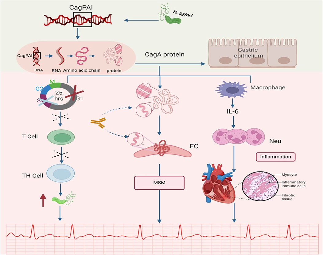 Illustration of a biological process involving the CagPAI DNA from Helicobacter pylori, leading to CagA protein synthesis. The pathway affects gastric epithelium, T cells, macrophages, and inflammation, contributing to cardiac implications. Inflammatory signals like IL-6 are shown leading to inflammation and effects on cardiac tissue with an ECG pattern displayed at the bottom.