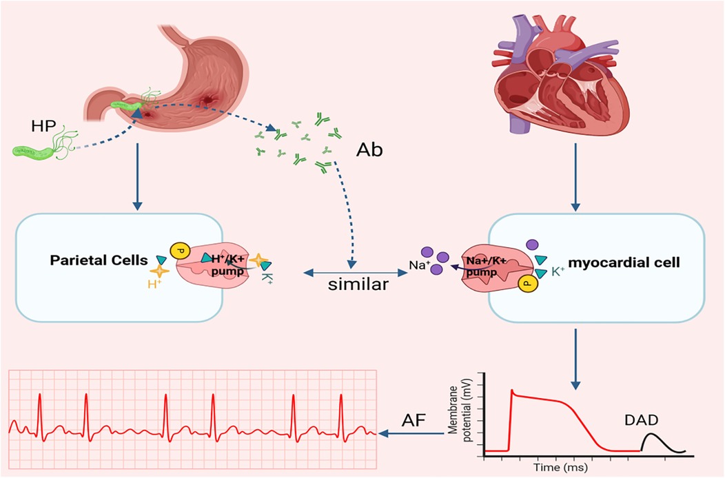 Diagram showing the interaction between Helicobacter pylori (HP) and parietal cells in the stomach, producing antibodies (Ab) that impact myocardial cells in the heart due to similar Na+/K+ and H+/K+ pumps. This interaction can lead to atrial fibrillation (AF), depicted in an electrocardiogram, and delayed afterdepolarizations (DAD), shown in a membrane potential graph.