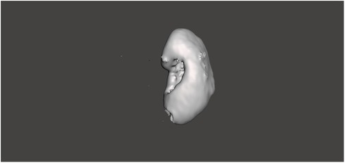 A 3D model of a human fetus shown in a side profile, displayed on a dark background. The model appears smooth and monochrome, emphasizing the contours and shape of the fetus.
