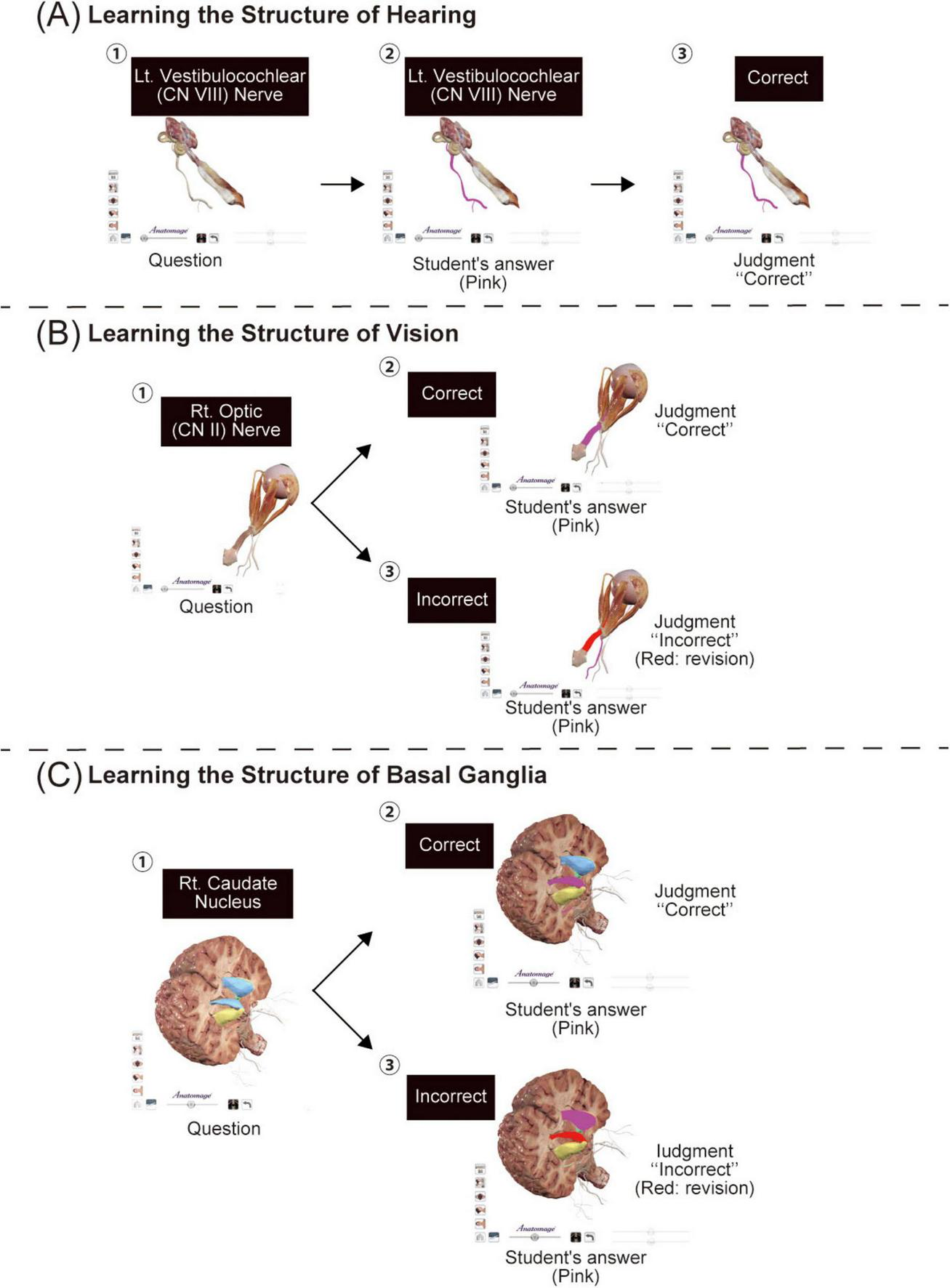 Diagram illustrating three anatomical learning processes: (A) Structure of Hearing, showing the left vestibulocochlear nerve with correct judgment. (B) Structure of Vision, depicting the right optic nerve with both correct and incorrect student answers. (C) Structure of Basal Ganglia, featuring the right caudate nucleus with correct and incorrect responses. Each section shows labeled questions and judgments based on student answers in pink and revisions in red.