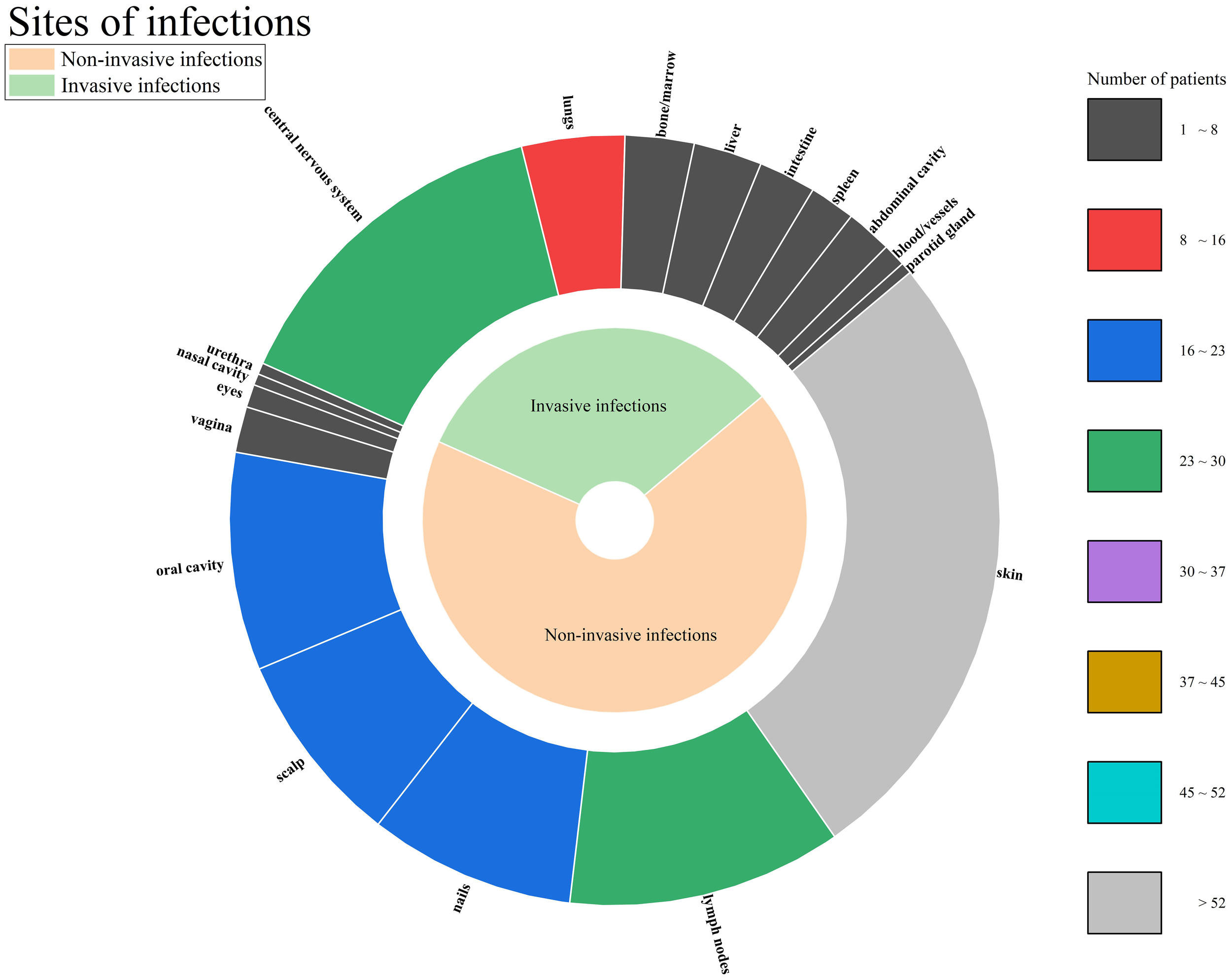 Circular chart depicting sites of infections categorized as invasive and non-invasive. Non-invasive infections include oral cavity, scalp, and nails, shown in blue and other colors. Invasive infections like central nervous system and lungs are in green. A legend indicates the number of patients with color codes ranging from 1 to over 52.