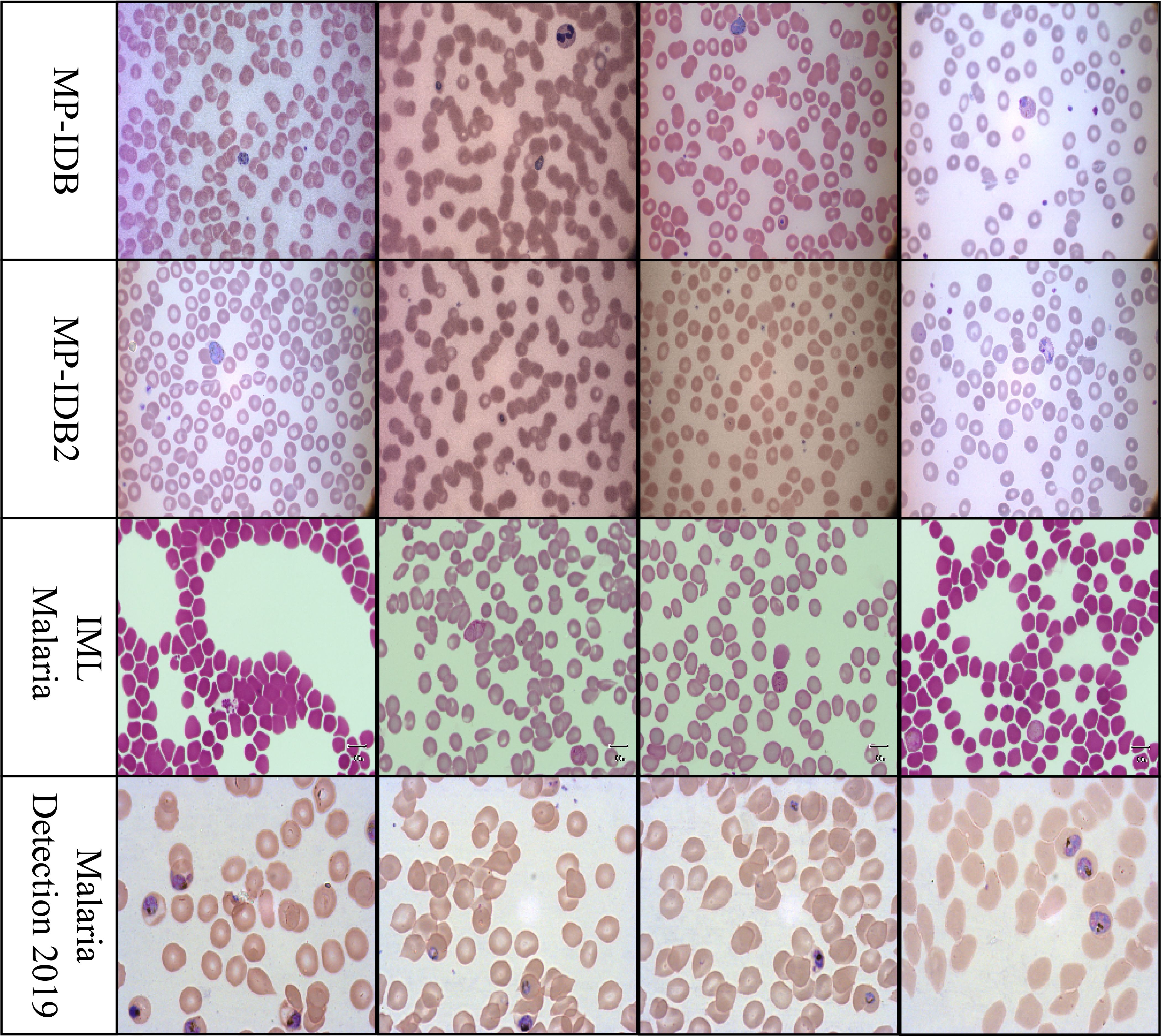 Grid of sixteen microscopic images showing red blood cells infected with malaria from four datasets: MP-IDB, MP-IDB2, IML Malaria, and Malaria Detection 2019. Each row represents a different dataset, displaying variations in cell appearance and staining.