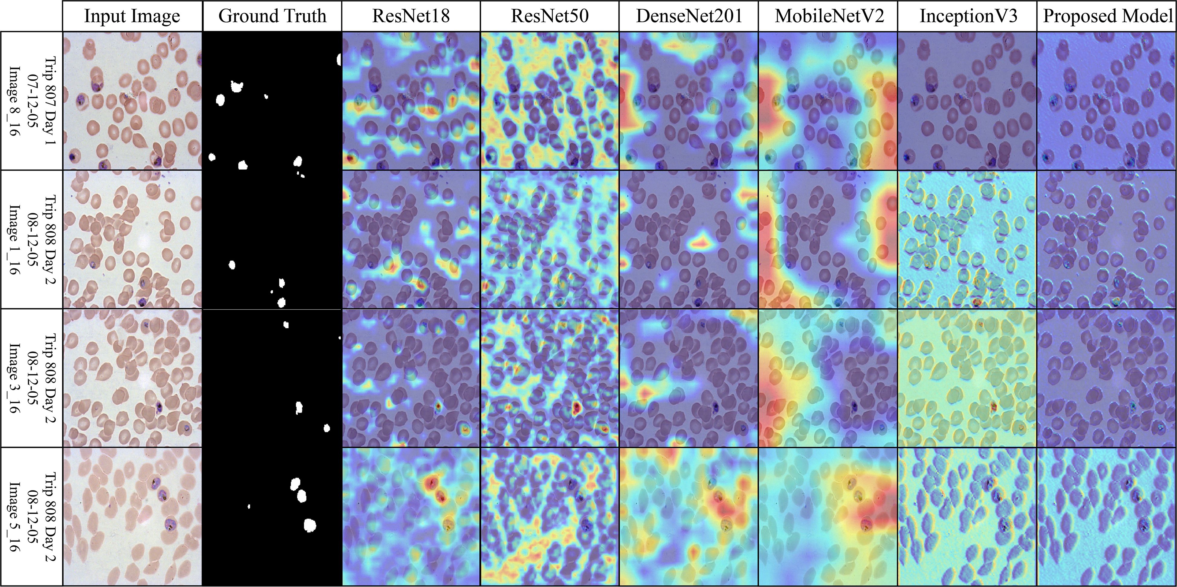 Grid of cell images comparing input, ground truth, and various models. Rows represent different samples, while columns show results from ResNet18, ResNet50, DenseNet201, MobileNetV2, InceptionV3, and a proposed model. Each model's output features overlaid heatmaps indicating detection accuracy.