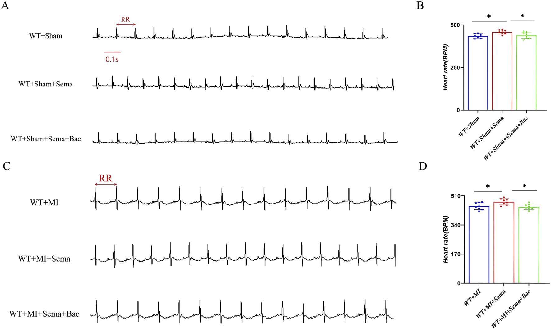 Electrocardiogram (ECG) traces and bar graphs depict heart rate variations under different conditions. Panels A and C show ECG lines for WT+Sham, WT+Sham+Sema, WT+Sham+Sema+Bac, and WT+MI, WT+MI+Sema, WT+MI+Sema+Bac, respectively, with RR intervals marked. Panels B and D present bar graphs comparing heart rates in beats per minute (BPM) for the same groups, showing significant differences marked by asterisks.
