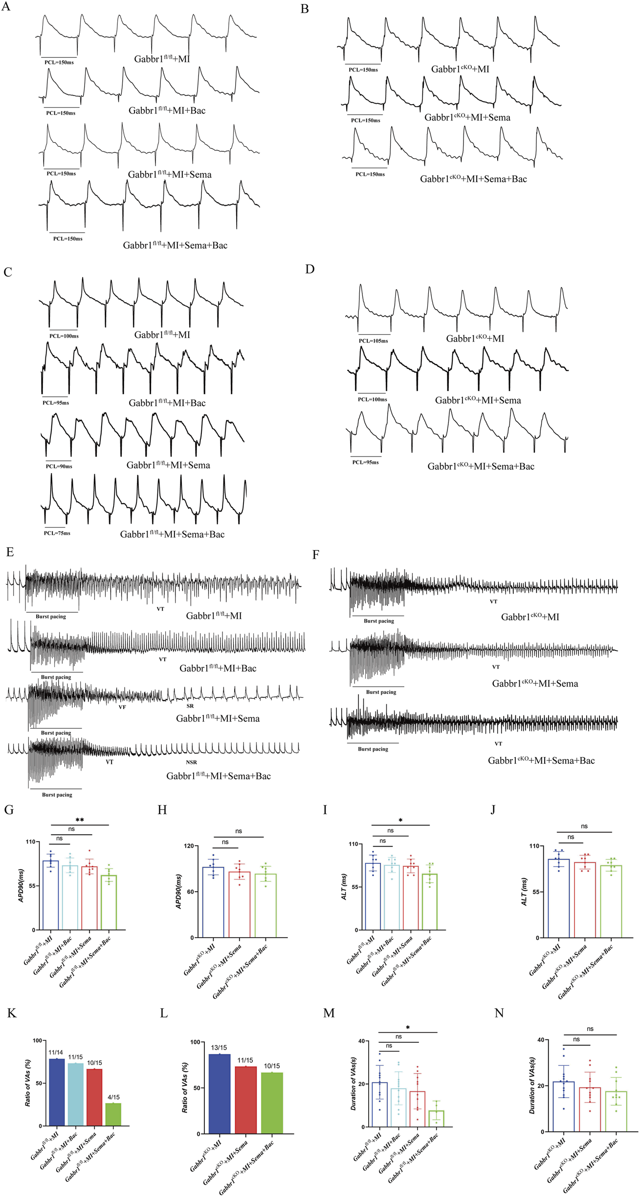 Grouped scientific illustrations and charts depict electrophysiological data and statistical analysis. Panels A to D show action potential recordings under different conditions. Panels E and F illustrate traces of burst pacing experiments. Panels G to N present bar graphs comparing parameters such as APD90, ALT, ratio, and duration of VFAs across various experimental groups. Each graph includes standard deviations and significance markers. Labels detail experimental conditions like genetic modifications and treatments with Bac, Sema, or both.