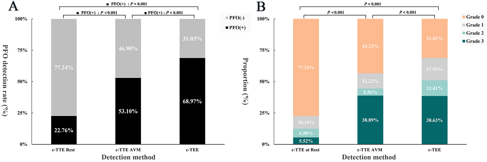 Two bar charts labeled A and B compare percentages of PFO incidence and classification grades during c-TTE at rest and c-TTE/TEE during VM. Chart A shows PFO negative (gray) versus PFO positive (black), highlighting significant increases from rest to VM. Chart B displays distribution of grades 0 to 3, illustrating a rise in higher grades from rest to VM, with noticeable increases in grades 2 and 3 during VM phases.