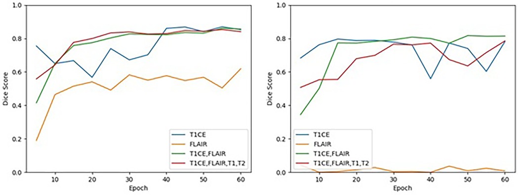 Two line graphs compare the Dice scores over epochs for four models: T1CE, FLAIR, T1CE plus FLAIR, and T1CE, FLAIR, T1, T2. The left graph shows fluctuating scores, while the right graph shows smoother increases, with the model combining T1CE, FLAIR, T1, and T2 consistently having higher scores. Scores generally range from 0.0 to 1.0 on the y-axis across 0 to 60 epochs on the x-axis.