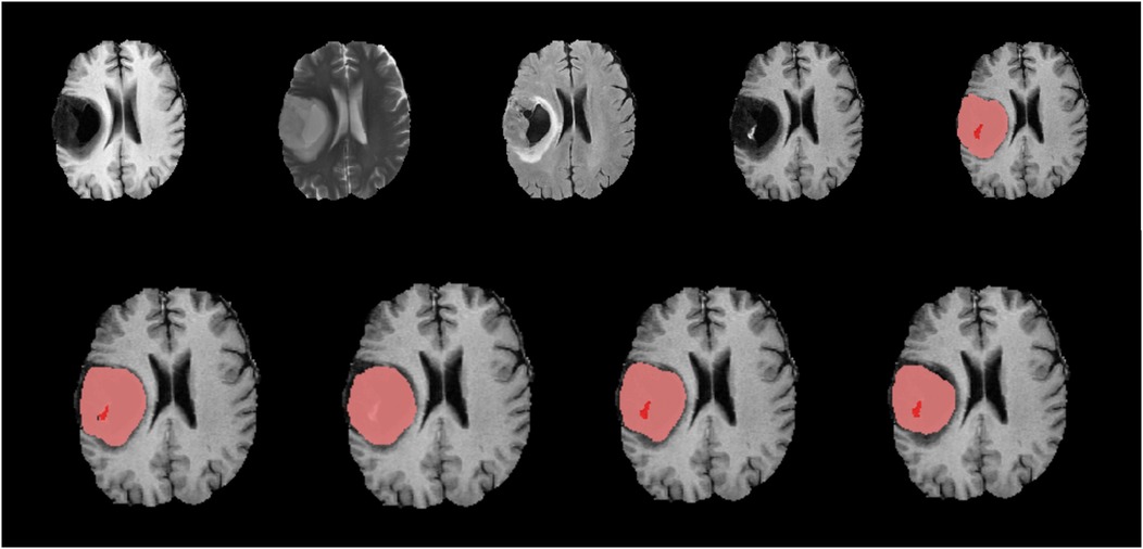MRI brain scans in two rows show different axial views. The top row features four scans with varying levels of contrast, highlighting brain structures. The bottom row shows scans with highlighted regions marked in red, indicating specific areas of interest for analysis.