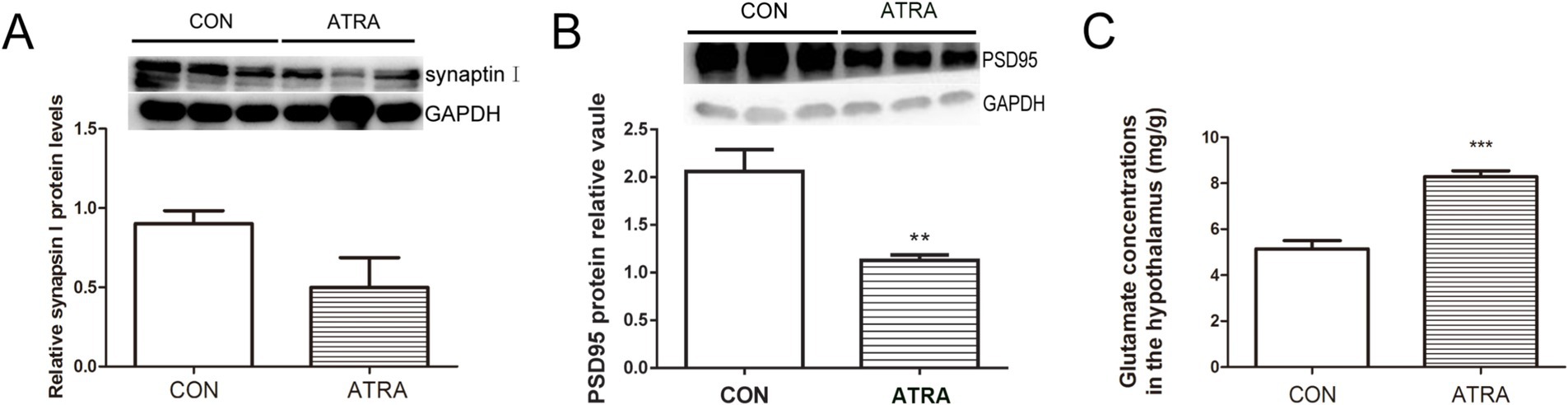 Three charts labeled A, B, and C compare protein levels and glutamate concentrations between control (CON) and all-trans retinoic acid (ATRA) groups. Chart A shows reduced synapsin I protein levels in the ATRA group. Chart B shows reduced PSD95 protein levels in the ATRA group, confirmed by a blot. Chart C shows increased glutamate concentrations in the hypothalamus for the ATRA group.