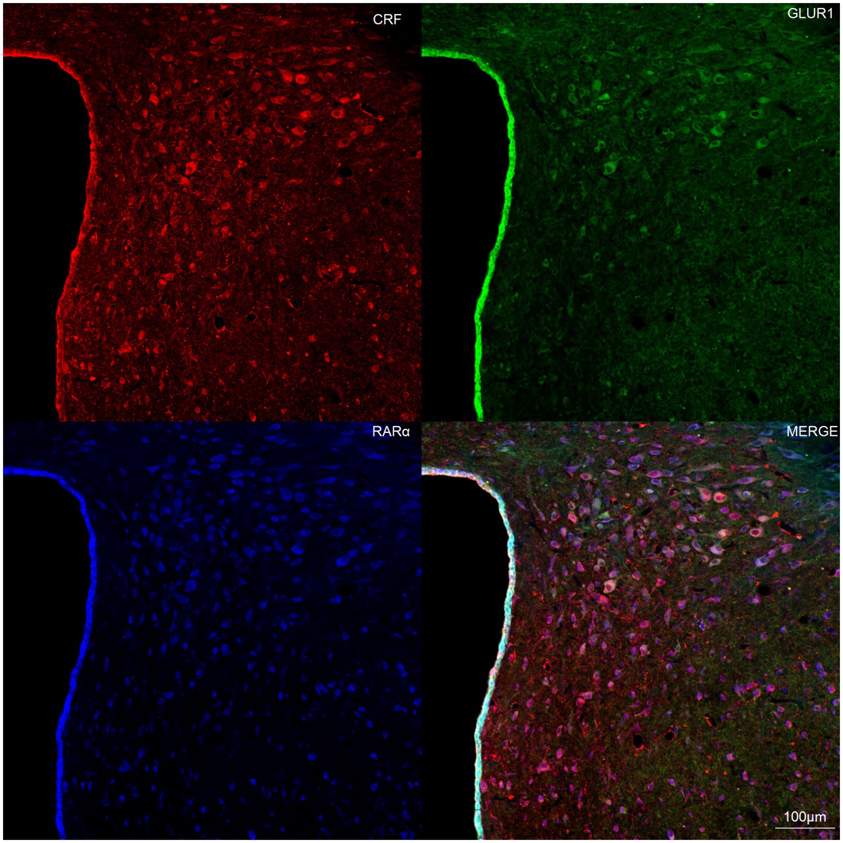 Fluorescence microscopy image showing four panels: Top left displays CRF in red, top right shows GLUR1 in green, bottom left illustrates RARα in blue, and the bottom right merges all three colors. The overlay highlights the colocalization in a tissue section, marked at 100 micrometers.