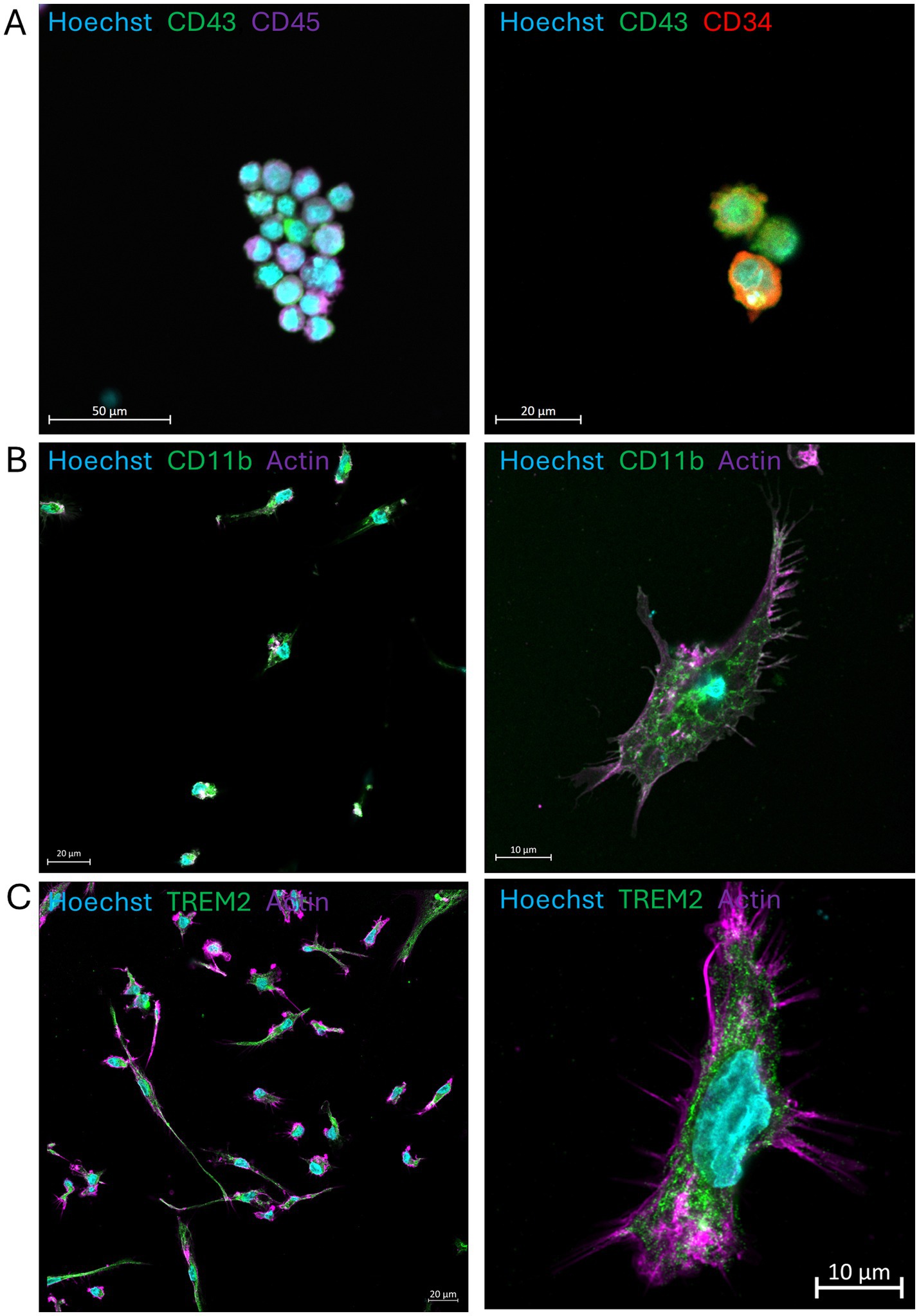 Composite microscopic images of cells stained with fluorescent dyes. Panel A shows cells labeled with Hoechst (cyan), CD43 (green), and CD45 (magenta); and Hoechst, CD43, and CD34 (red). Panel B depicts cells stained with Hoechst, CD11b (green), and Actin (magenta), with one large cell extending. Panel C illustrates cells labeled with Hoechst, TREM2 (green), and Actin (magenta), highlighting one prominently elongated cell. Scale bars indicate micrometer measurements.