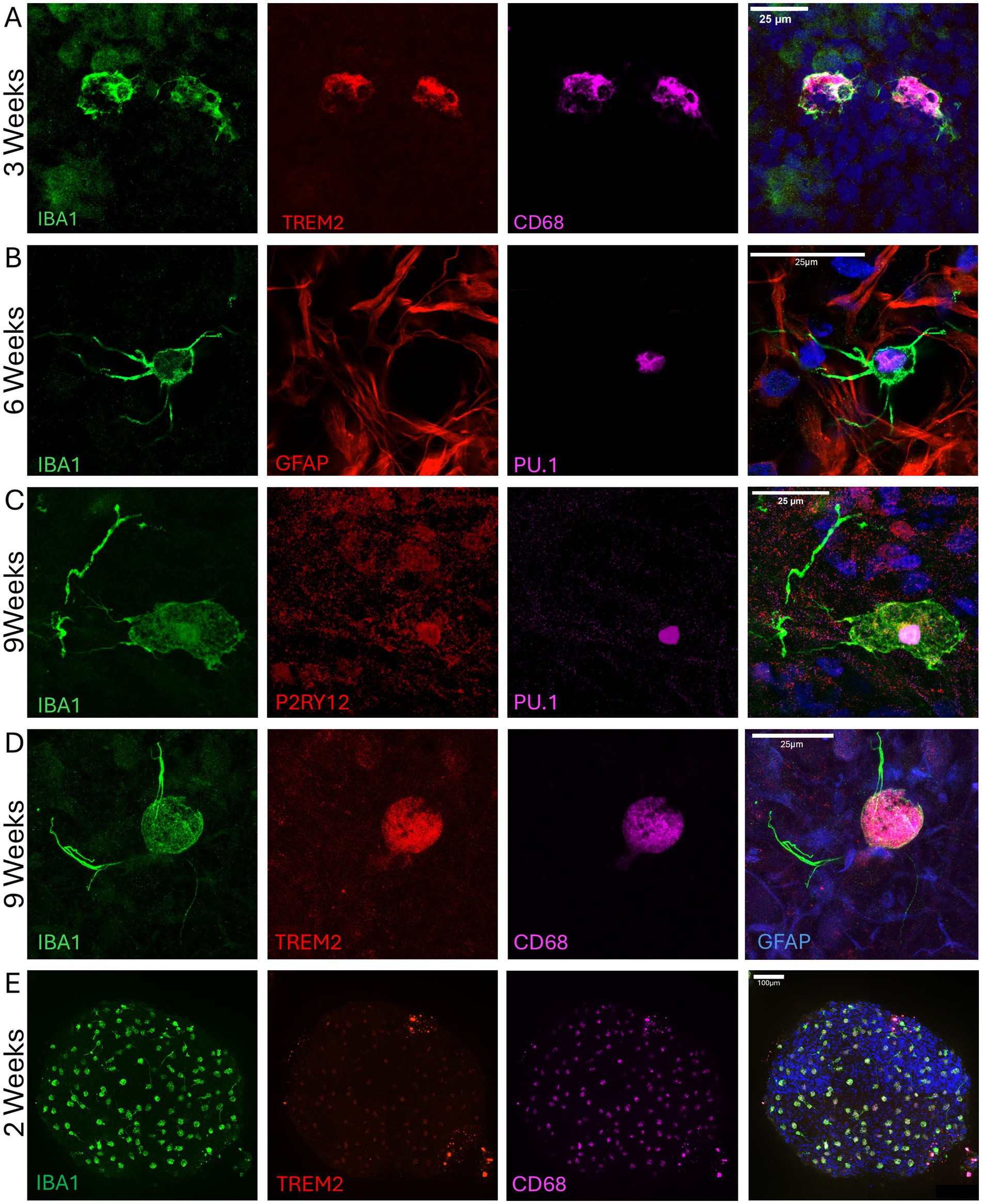 Fluorescent micrographs of cells at different weeks. Panel A (3 weeks) shows IBA1, TREM2, and CD68 markers. Panel B (6 weeks) shows IBA1, GFAP, and PU.1 markers. Panel C (9 weeks) displays IBA1, P2RY12, and PU.1 markers. Panel D (9 weeks) includes IBA1, TREM2, and CD68 markers. Panel E (2 weeks) contains IBA1, TREM2, and CD68 markers. Each panel presents cells in various fluorescent colors indicating different markers and development stages. Magnification bars are included.