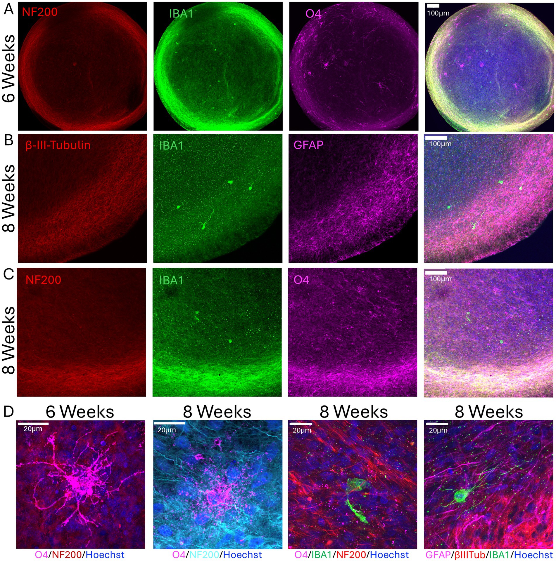 Fluorescent microscopy images of brain organoid development at 6 and 8 weeks, stained to highlight various proteins. Panel A shows NF200, IBA1, and O4 at 6 weeks. Panel B features β-III-Tubulin, IBA1, and GFAP at 8 weeks. Panel C displays NF200, IBA1, and O4 at 8 weeks. Panel D presents detailed views with multiple staining combinations, highlighting cellular complexity at 20 micrometers. Each image uses distinct color channels to differentiate specific markers within the tissue. Scale bars provided are 100 or 20 micrometers.