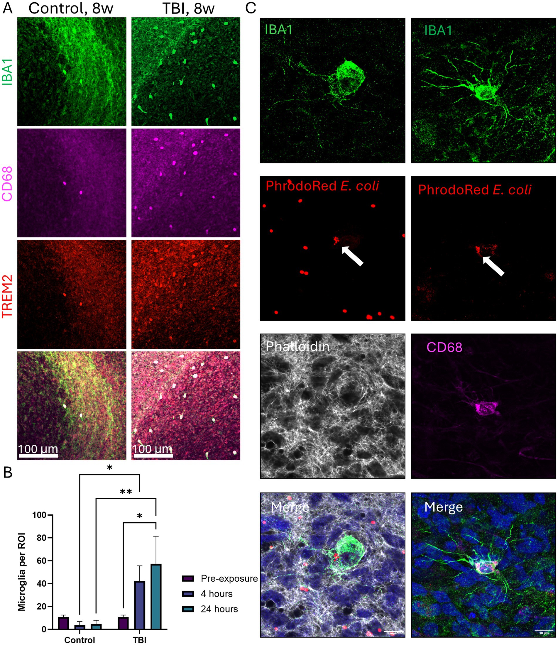 Panel A shows fluorescent images of brain tissue from control and TBI groups at 8 weeks, stained for IBA1 (green), CD68 (purple), and TREM2 (red), along with merged images. Panel B displays a bar graph comparing microglia per region of interest under control and TBI conditions at pre-exposure, 4 hours, and 24 hours post-exposure with indicated significance levels. Panel C includes fluorescent microscopy of microglia stained with IBA1 (green) and images showing bacteria uptake with PhrodoRed E. coli (red). Additional stains include Phalloidin (gray) and CD68 (purple), with merged images for comparison.